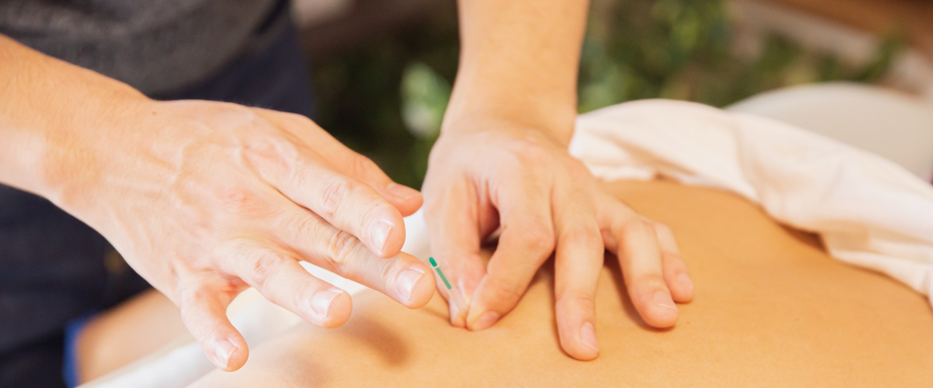 The Bronx, NY, Blueprint For Mental Health: Unveiling Acupuncture's Benefits At The Clinic