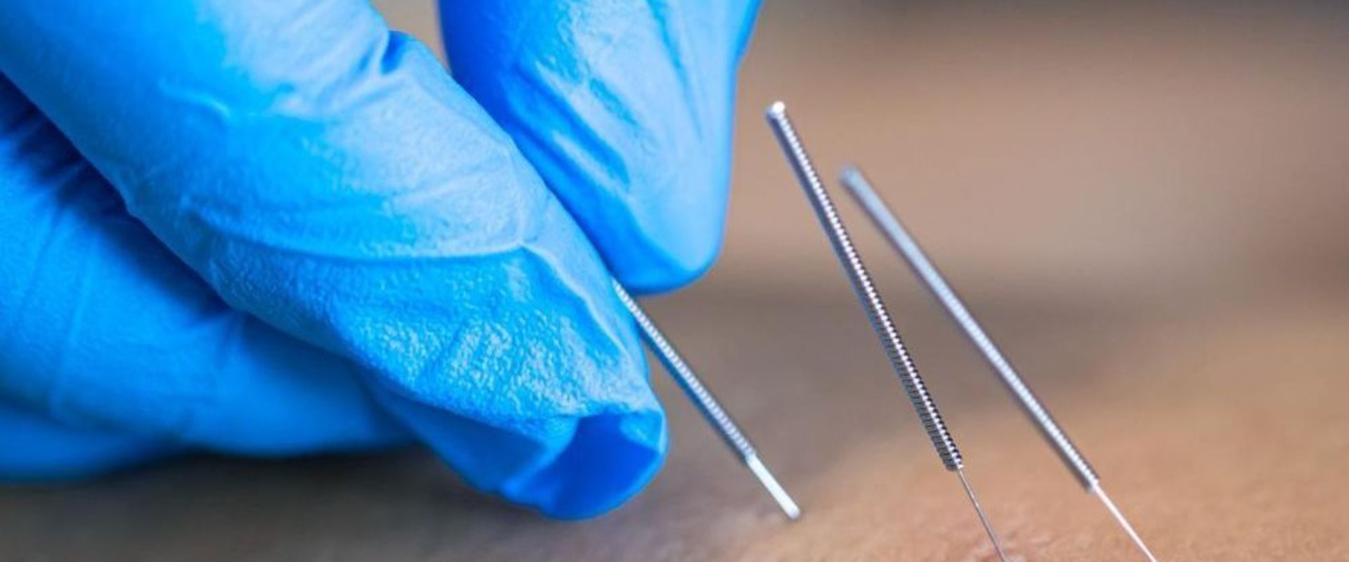 Discover How Awake Lipo Complements Acupuncture in Arizona