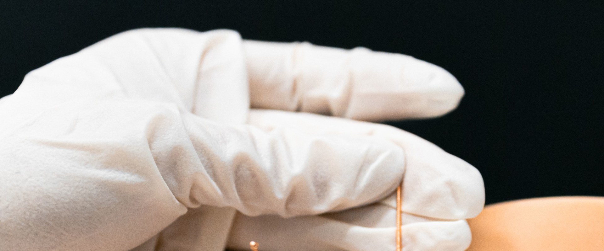 Discover the Benefits of Acupuncture in Inpatient Drug Rehab