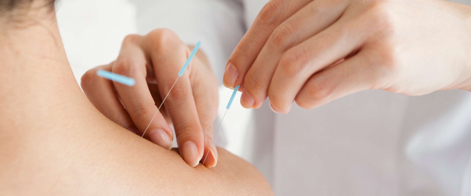 What Health Problems Can Acupuncture Solve?