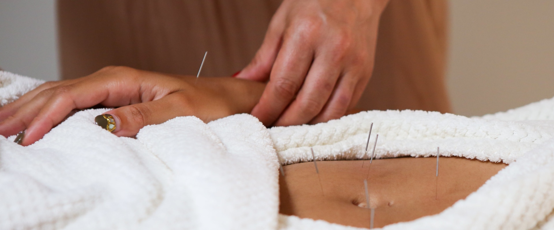 Discover Wellness with Acupuncture and Skin Care in Tarzana