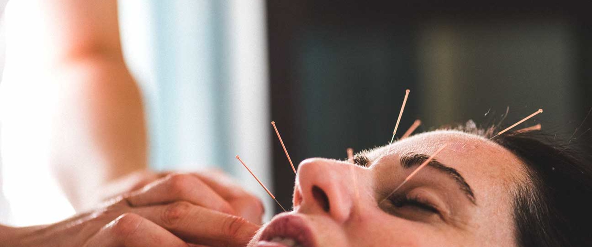 What are the Side Effects of Acupuncture Treatment?