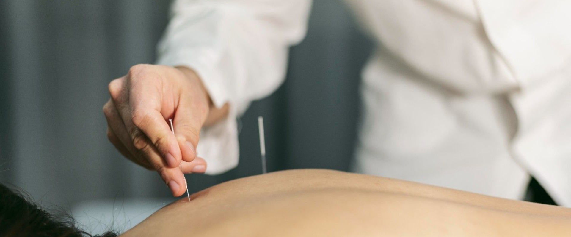 Discover How Acupuncture Supports Rehab in Dallas