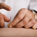 Can Children Receive Acupuncture Treatments?