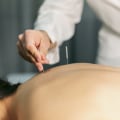 Discover How Acupuncture Supports Rehab in Dallas