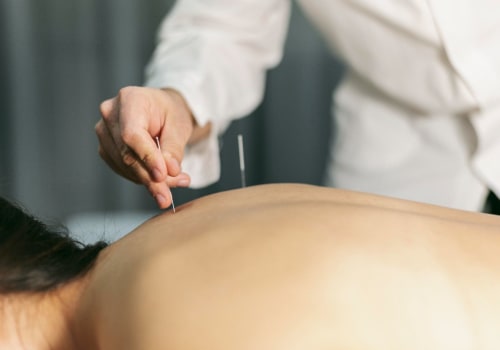Discover How Acupuncture Supports Rehab in Dallas